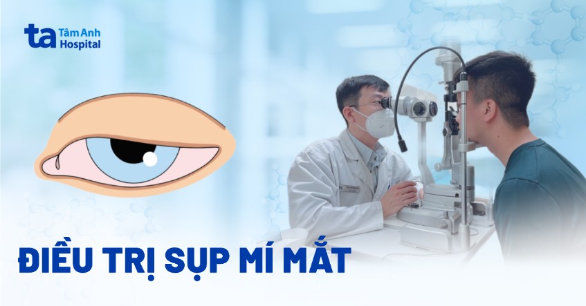 điều trị sụp mí mắt
