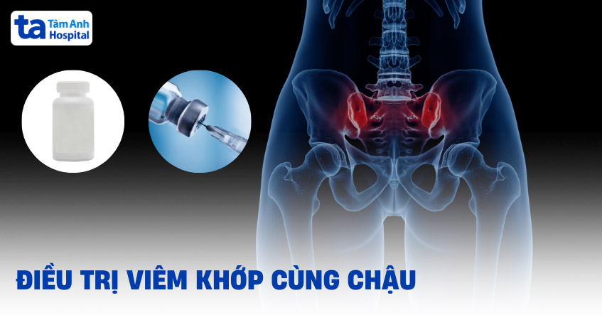 8 cách điều trị viêm khớp cùng chậu, giảm đau hiệu quả