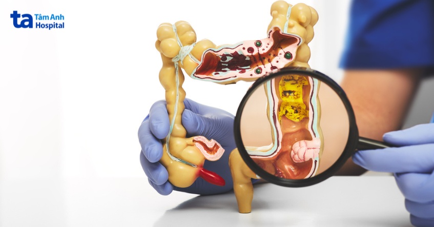 đối tượng có nguy cơ cao