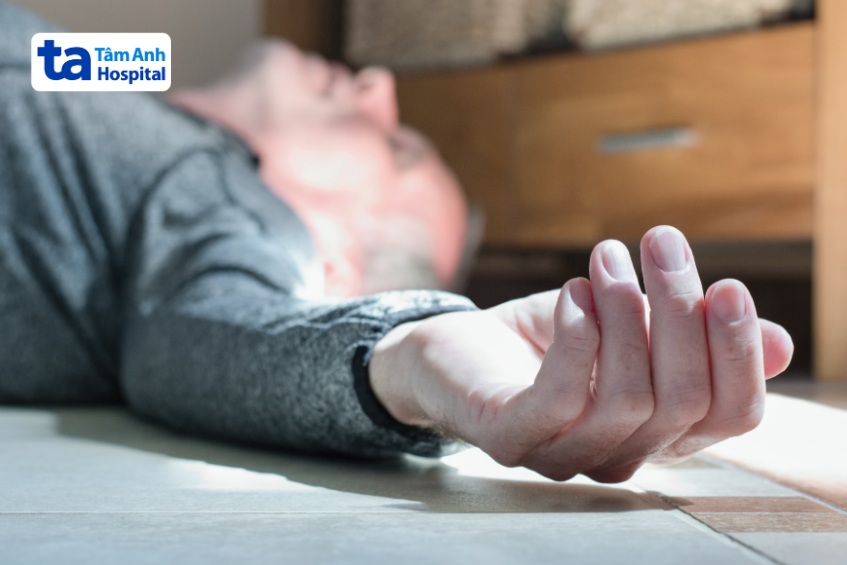 động kinh biến chứng xuất huyết dưới nhện