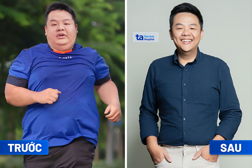 Kết quả giảm cân tại BVĐK Tâm Anh