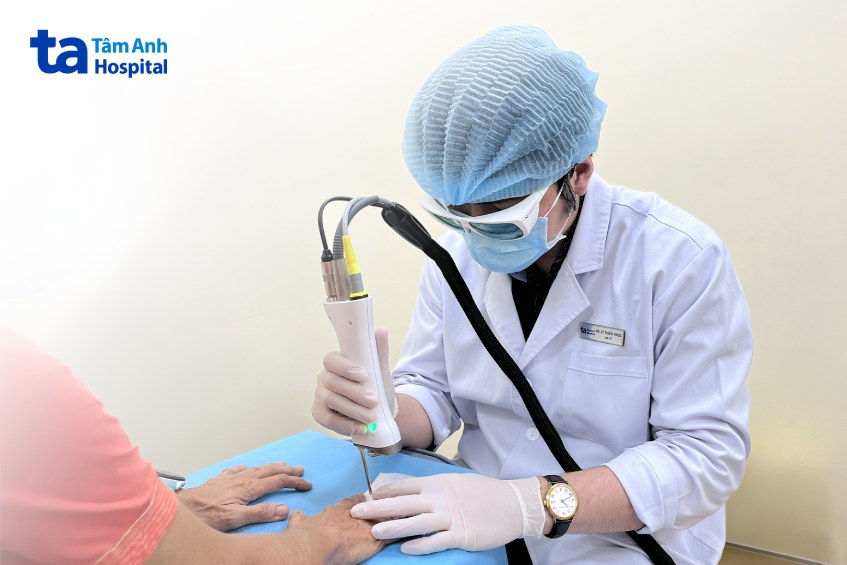 hình ảnh bác sĩ điều trị nấm móng cho bệnh nhân