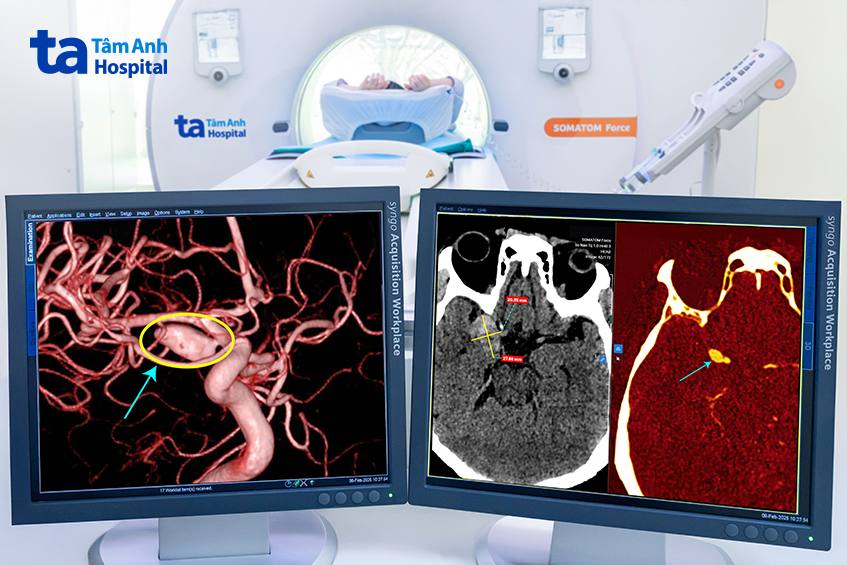 hình ảnh từ máy chụp ct