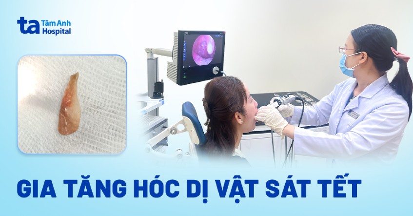 hóc dị vật