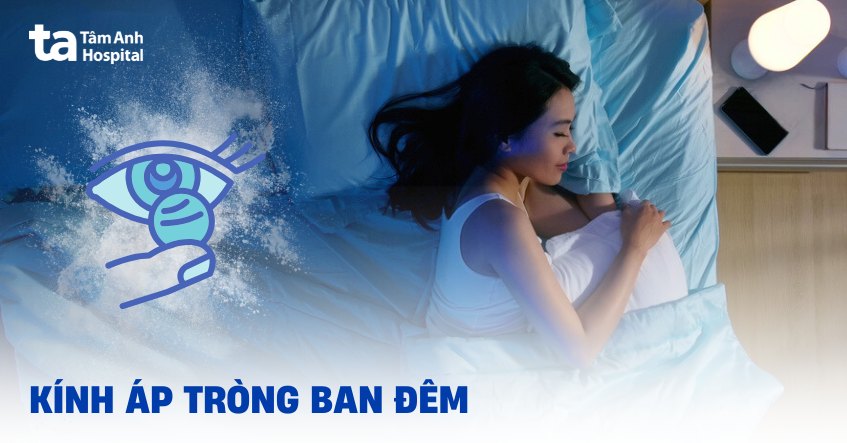 Có nên đeo kính áp tròng ban đêm Ortho-k không? Một số lưu ý