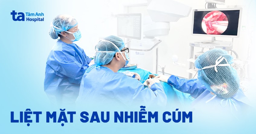 liệt mặt sau nhiễm cúm