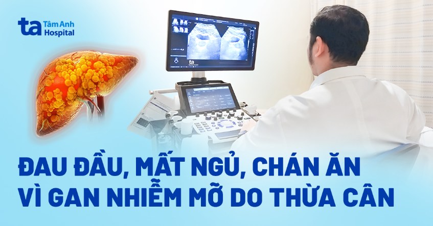 Đau đầu, mất ngủ, chán ăn vì gan nhiễm mỡ do thừa cân