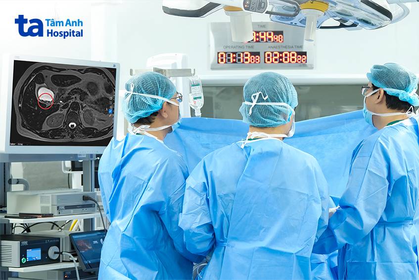 mổ khẩn cấp do sỏi