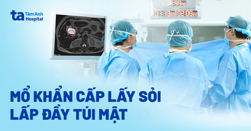 mổ khẩn cấp lấy sỏi