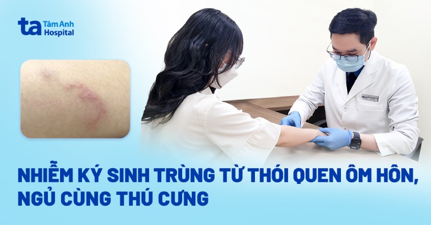 Nhiễm ký sinh trùng từ thói quen ôm hôn, ngủ cùng thú cưng