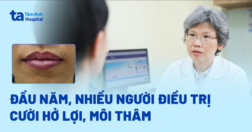 nhiều người điều trị hở lợi môi thâm