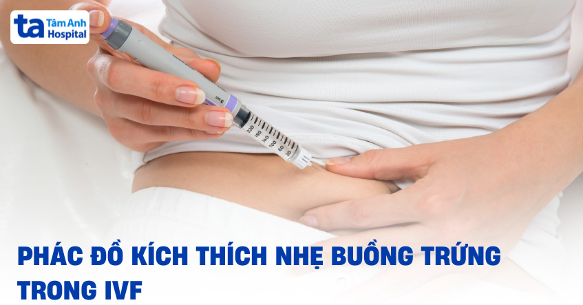 Phác đồ kích thích nhẹ buồng trứng: Ưu điểm, chỉ định và quy trình