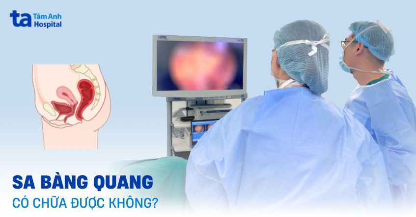 Sa bàng quang có chữa được không? Có tự khỏi không?