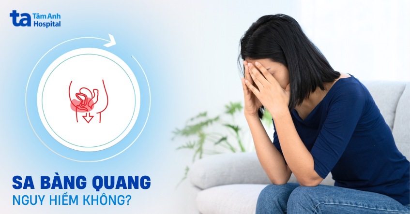 Sa bàng quang có nguy hiểm không? Biện pháp phòng ngừa hiệu quả
