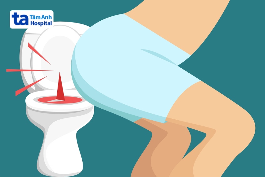 sa búi trĩ tự co lại không