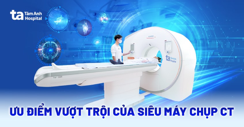 siêu máy chụp ct