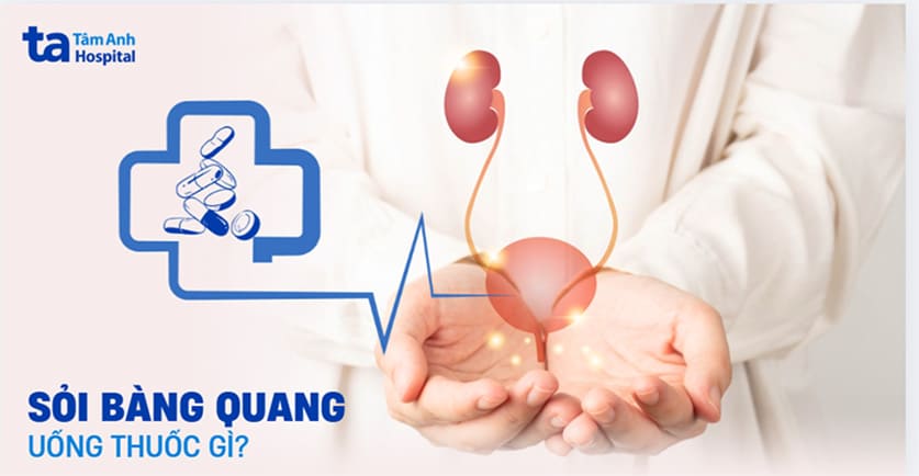 Sỏi bàng quang uống thuốc gì mau khỏi? Cần phải lưu ý những gì?
