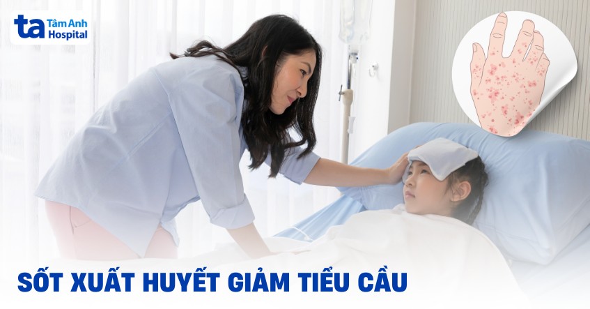 Bị sốt xuất huyết giảm tiểu cầu: Nguyên nhân và dấu hiệu nhận biết