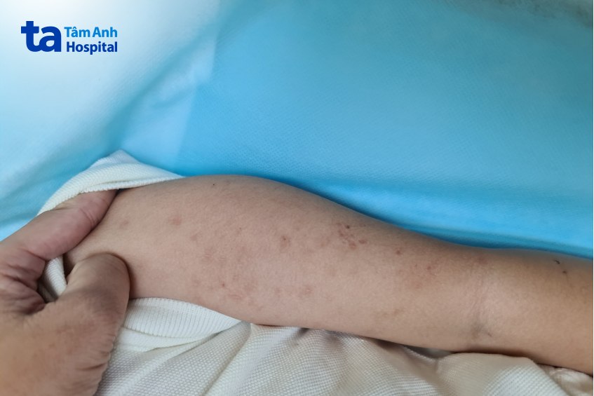 sức đề kháng yếu