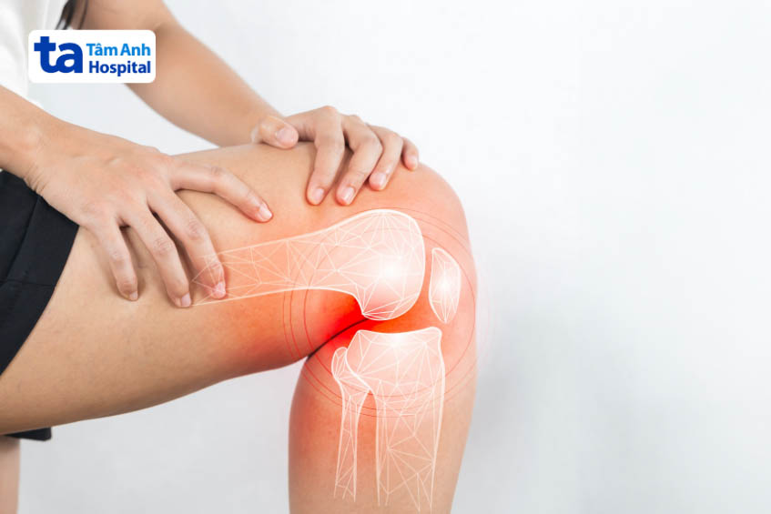 Sưng khớp đầu gối