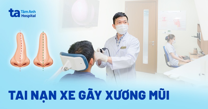 tai nạn xe gãy xương mũi