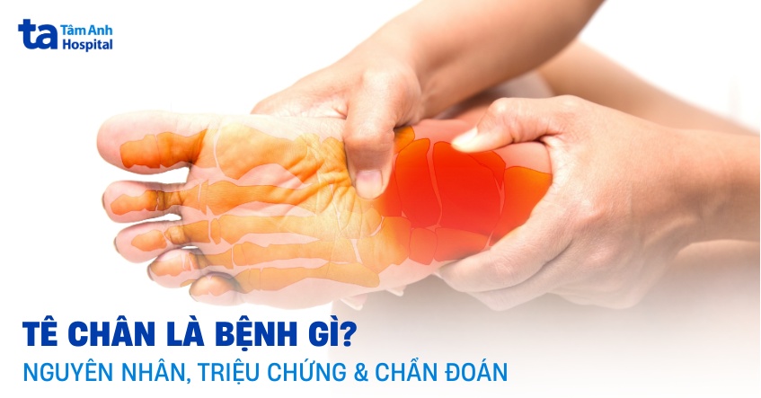 tê chân