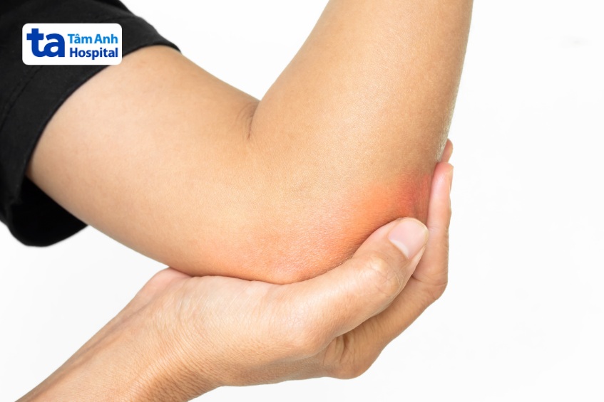 tê có thể xảy ra ở nhiều vùng trên cơ thể