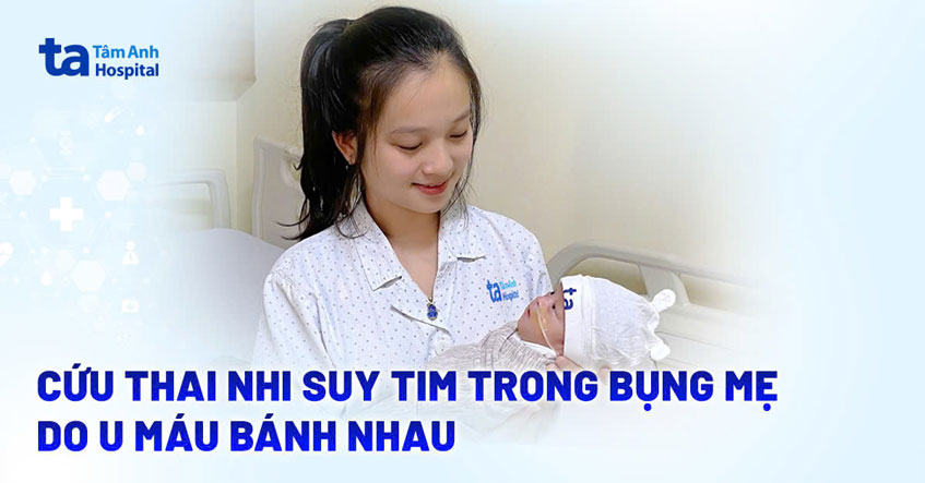Thai phụ bị u máu bánh nhau
