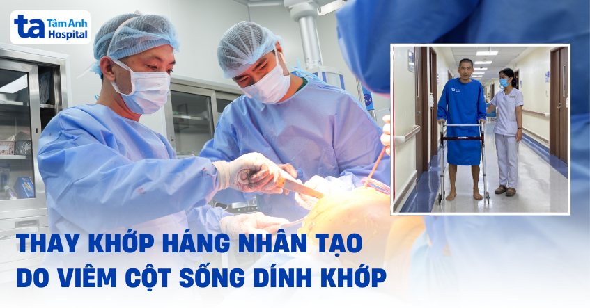 Thay khớp do điều trị viêm cột sống dính khớp không đúng cách
