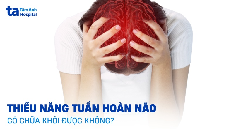 thiểu năng tuần hoàn não có chữa khỏi được không