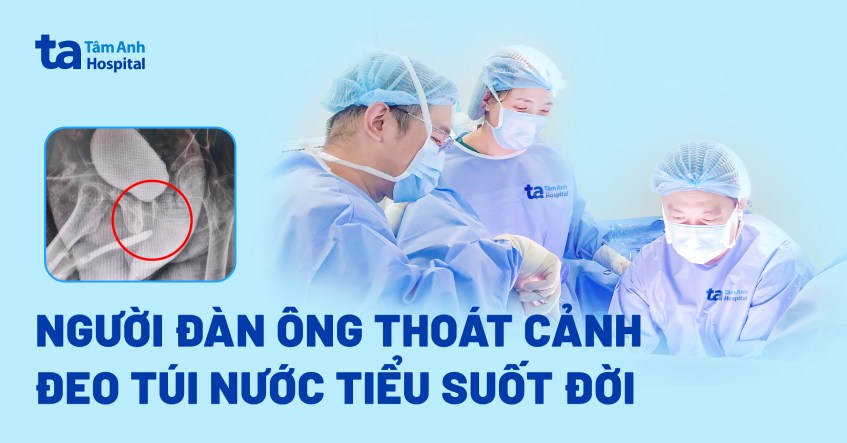 Người đàn ông thoát cảnh đeo túi nước tiểu suốt đời