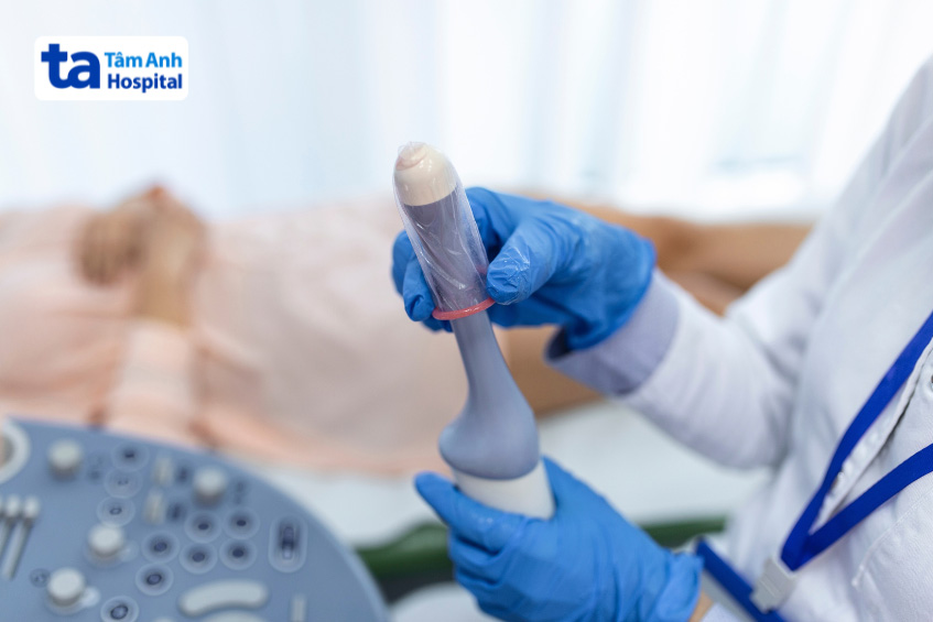 Thời điểm thực hiện siêu âm bơm nước tử cung phù hợp là khi bệnh nhân sạch kinh