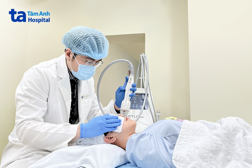 tình trạng lỗ chân lông to được điều trị bằng vi kim rf