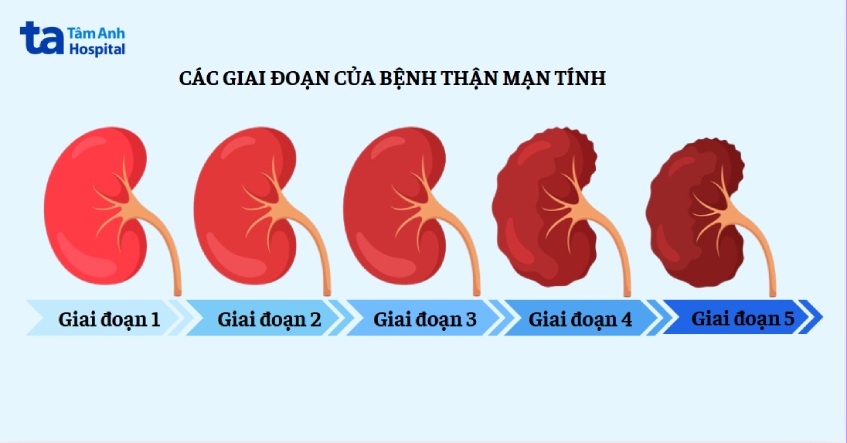 tóm tắt các giai đoạn suy thận