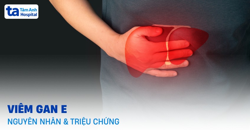 viêm gan e