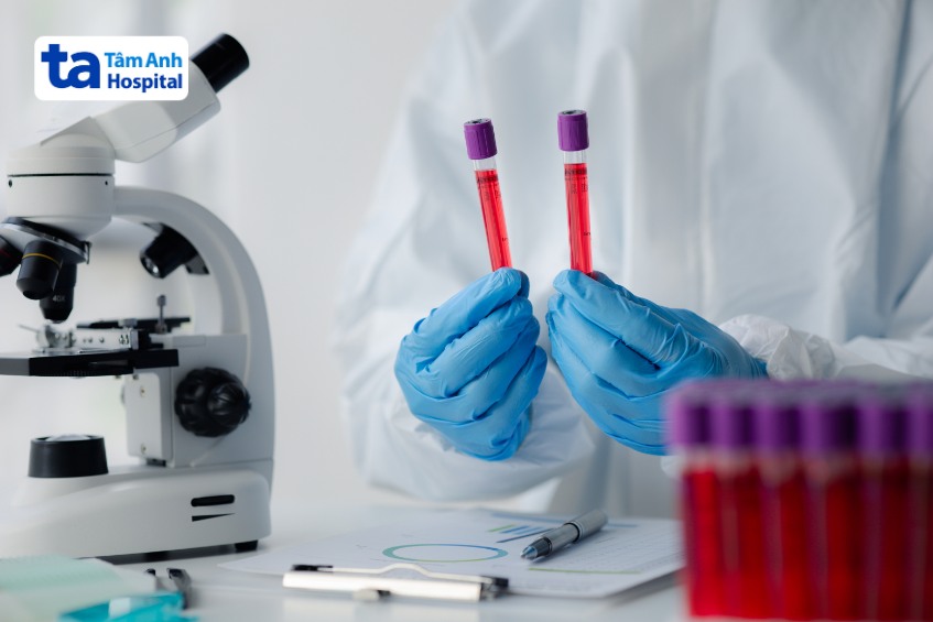 viêm gan siêu vi e