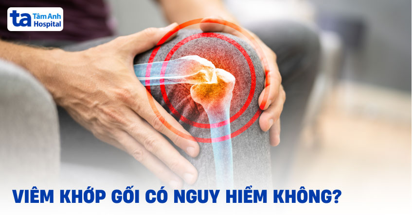 Viêm khớp gối có nguy hiểm không