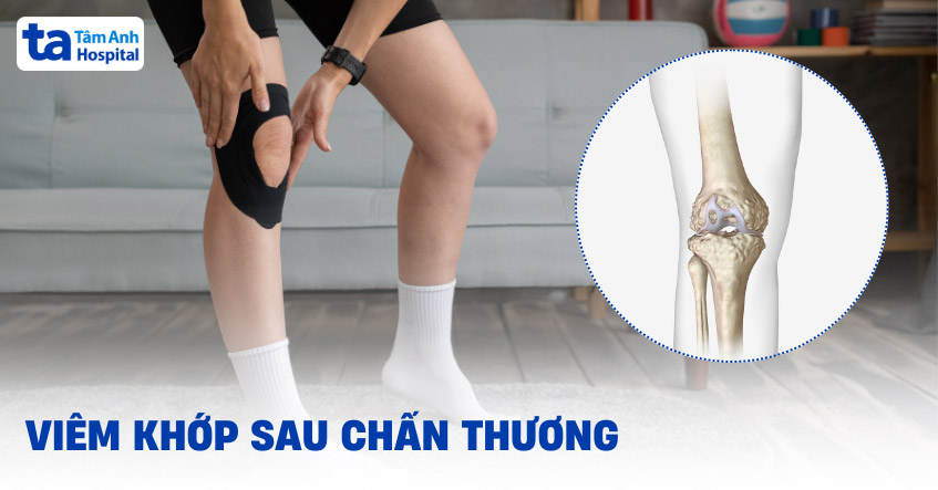 Viêm khớp sau chấn thương