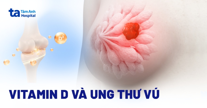 Vitamin D và ung thư vú: Thống kê, mối liên hệ và nguy cơ ảnh hưởng