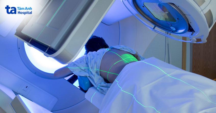 xạ trị chữa ung thư đại tràng