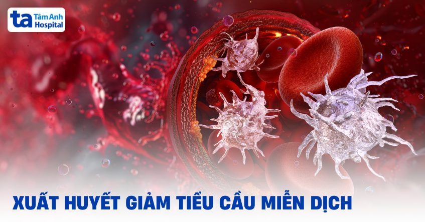 Xuất huyết giảm tiểu cầu miễn dịch (ITP): Nguyên nhân và triệu chứng