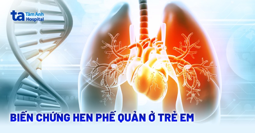 7 biến chứng hen phế quản ở trẻ em có thể bạn chưa biết
