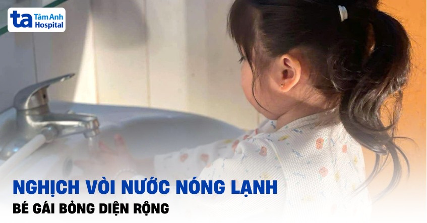 Nghịch vòi nước nóng lạnh, bé gái bỏng diện rộng
