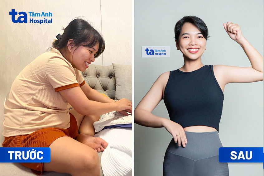 Chị Ngô Trần Thanh Thảo trước và sau giảm cân
