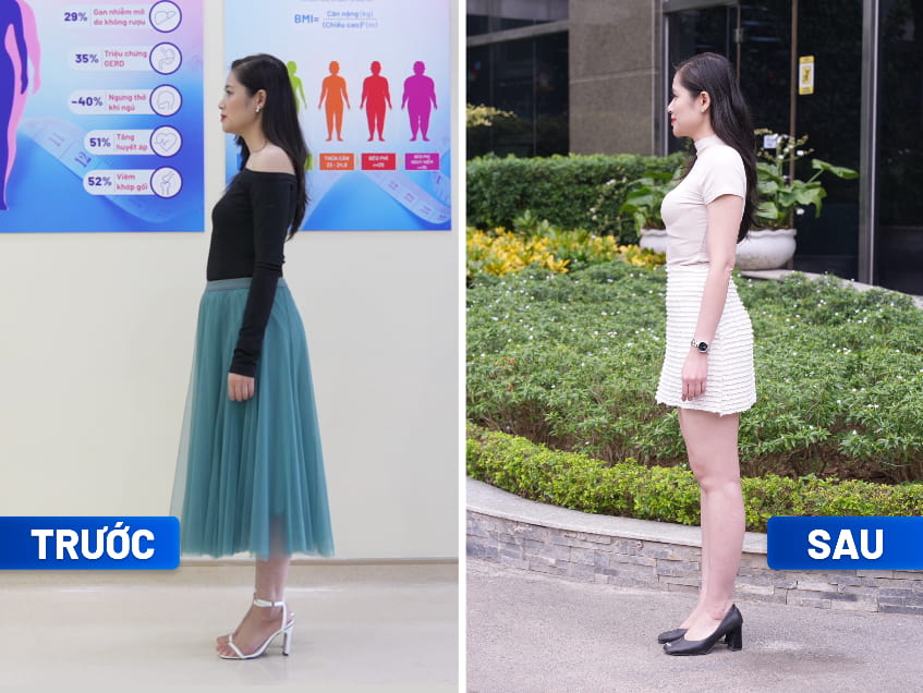 Kết quả giảm cân, giảm béo tại BVĐK Tâm Anh