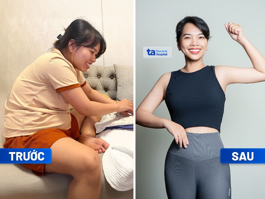 Những lưu ý khi ăn chuối chín để dáng đẹp, không mập, không ốm