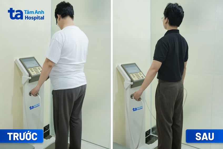 Tư vấn kiểm soát cân nặng tại BVĐK Tâm Anh