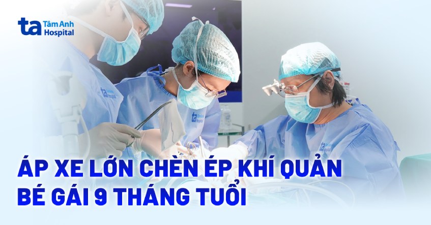 Tưởng nổi hạch do sốt, hóa áp xe chèn ép khí quản