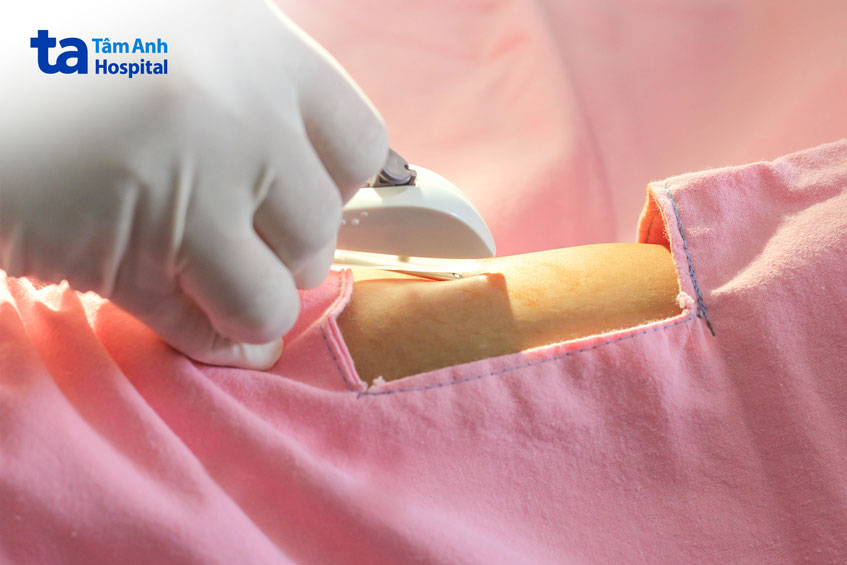 bác sĩ phẫu thuật lấy que ra cho bệnh nhân