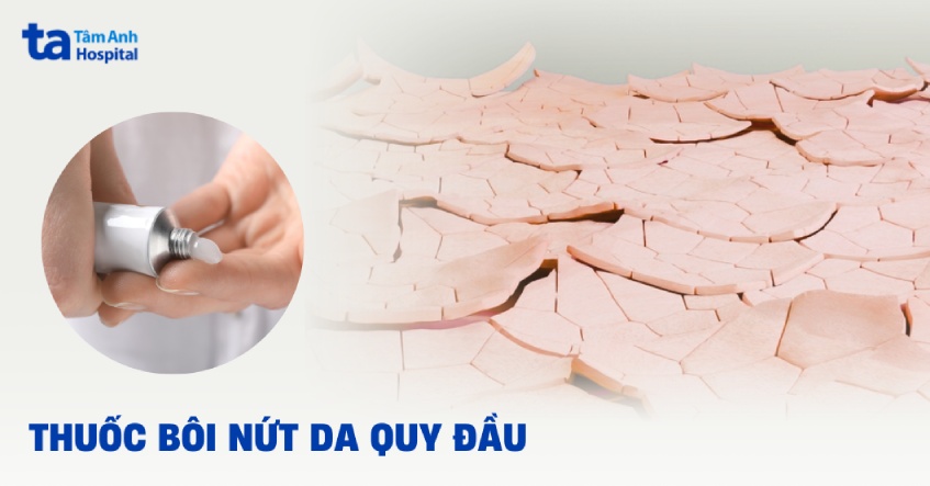 Bao quy đầu bị khô nứt bôi thuốc gì chữa dứt điểm tại nhà?